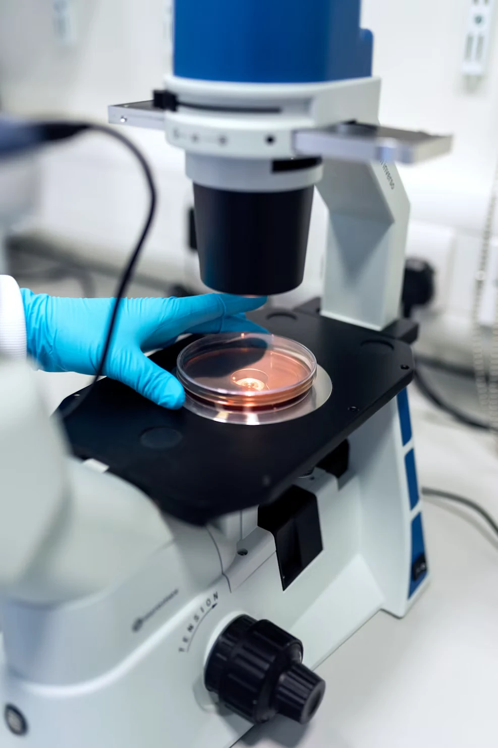Mano con guante colocando una caja de Petri en la platina de un microscopio invertido