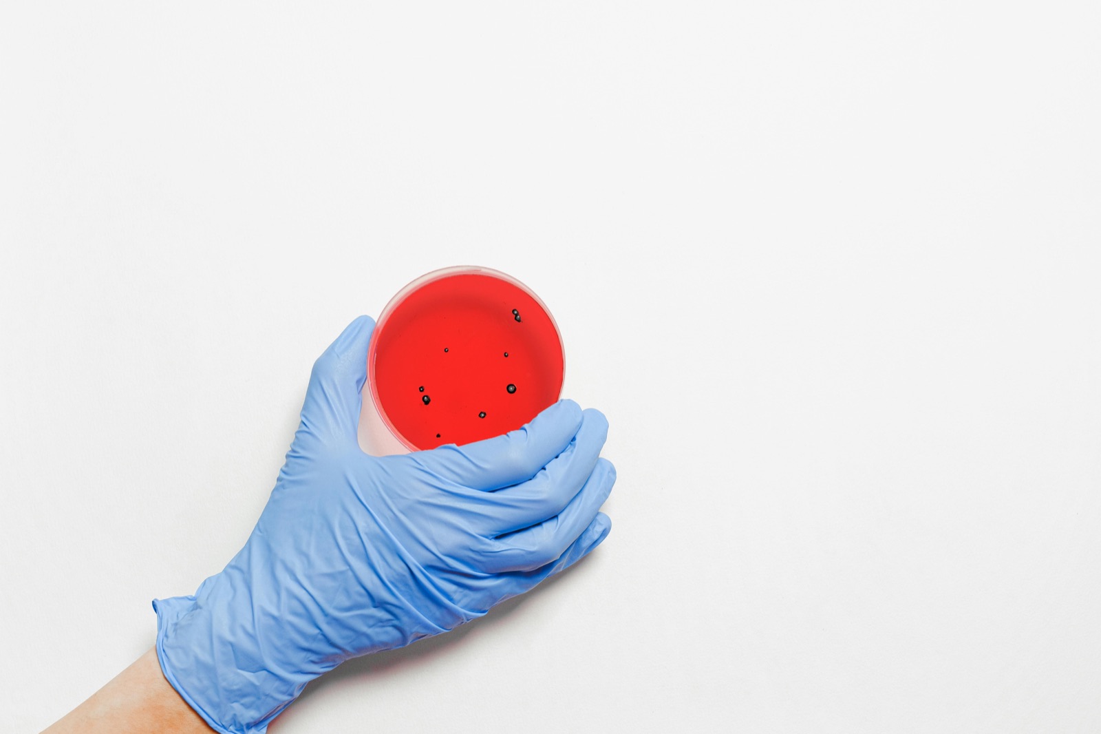 Placa de cultivo bacteriológico sostenida con guante de nitrilo